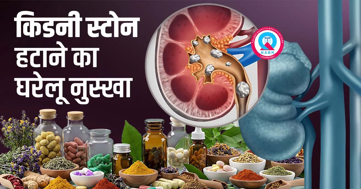 किडनी-स्टोन-हटाने-का-घरेलू-नुस्खा